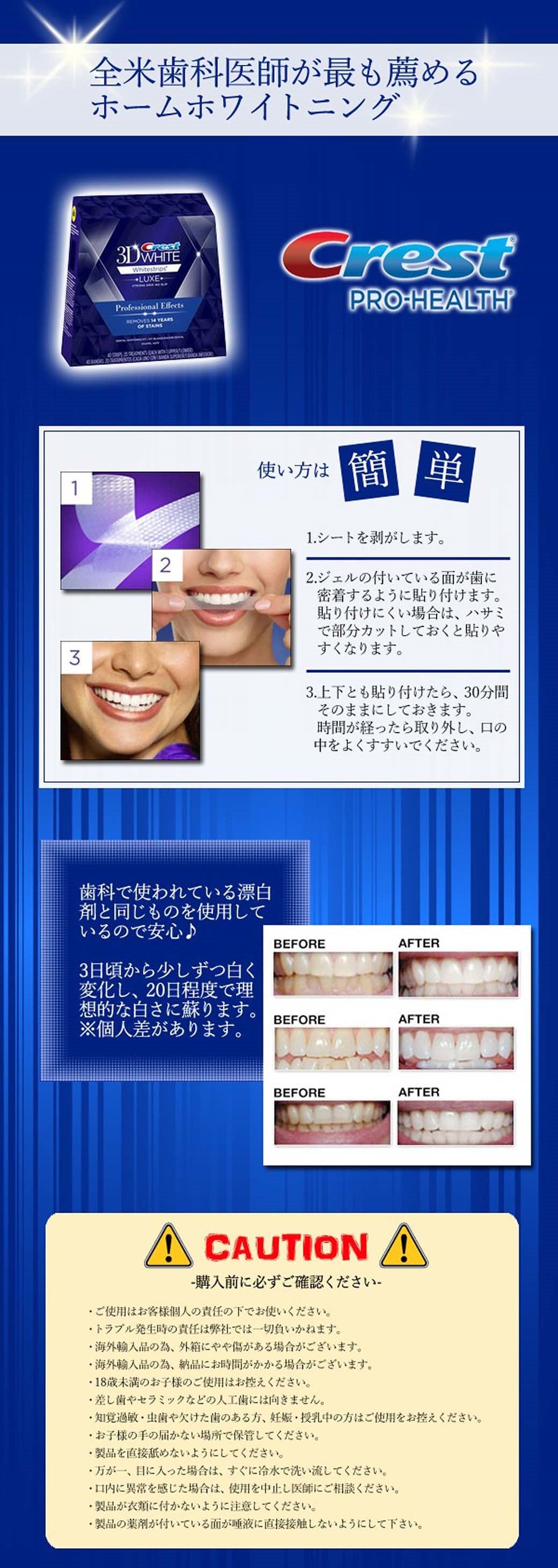 Crest3D ホワイトストリップス ホワイトニングシート プロフェッショナルエフェクツ 20回分